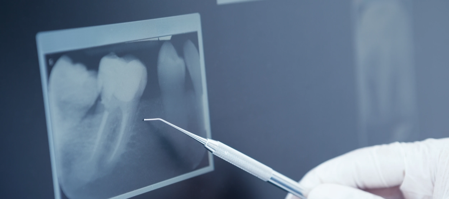 escaner clinica dental eider lasa