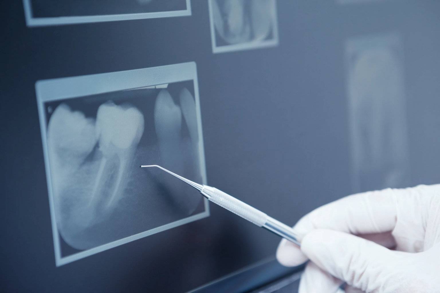 escaner clinica dental eider lasa
