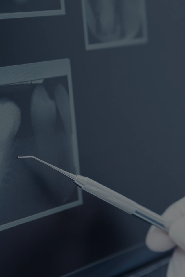 escaner clinica dental eider lasa